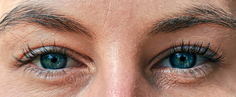 Signe Des Cils De Souque